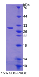 半胱氨酸丰富分泌蛋白1(CRISP1)重组蛋白