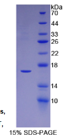 半乳糖凝集素1(GAL1)重组蛋白