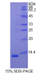 S100钙结合蛋白A4(S100A4)重组蛋白