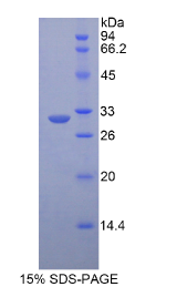 低密度脂蛋白受体相关蛋白6(LRP6)重组蛋白