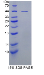 组织内转化生长因子β结合蛋白1(LTBP1)重组蛋白