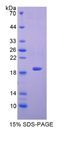 半乳糖凝集素7(GAL7)重组蛋白