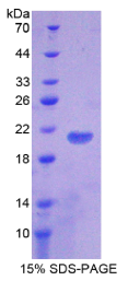 Toll样受体7(TLR7)重组蛋白