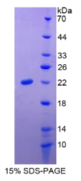 Slit同源物3(Slit3)重组蛋白
