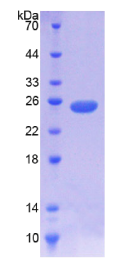 Nodal同源物(NODAL)重组蛋白