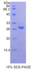 白介素22受体α2(IL22Rα2)重组蛋白