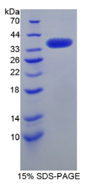 SRSF蛋白激酶3(SKL3)重组蛋白