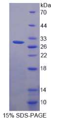 SCO细胞色素氧化酶缺陷同源物2(SCO2)重组蛋白