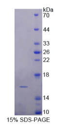 多巴胺受体D1(DRD1)重组蛋白