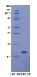 转化生长因子β1(TGFβ1)重组蛋白