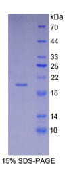 周期素依赖性激酶抑制因子2A(CDKN2A)重组蛋白