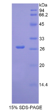 白介素2受体β(IL2Rβ)重组蛋白