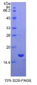 白介素15(IL15)重组蛋白