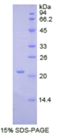 Thy1细胞表面抗原(Thy1)重组蛋白