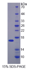 SH3域结合谷氨酸丰富蛋白样蛋白(SH3BGRL)重组蛋白