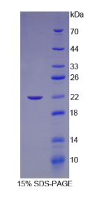 层粘连蛋白γ2(LAMγ2)重组蛋白