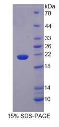 白介素1ε(IL1ε)重组蛋白