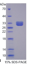 肿瘤坏死因子受体超家族成员1B(TNFRSF1B)重组蛋白
