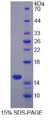 Sideroflexin 1蛋白(SFXN1)重组蛋白