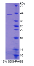 S100钙结合蛋白A14(S100A14)重组蛋白