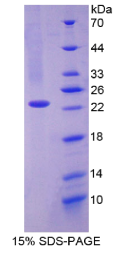 CD27结合蛋白(CD27BP)重组蛋白