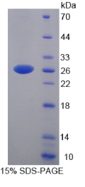 YY1关联因子2(YAF2)重组蛋白