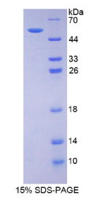 雌激素受体β(ERβ)重组蛋白