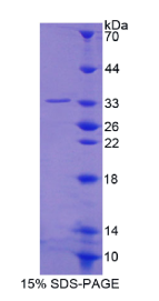 纺锤体蛋白1(SPIN1)重组蛋白
