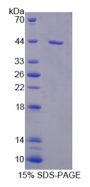 白介素5(IL5)重组蛋白