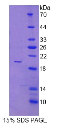 表面活性物质关联蛋白B(SPB)重组蛋白