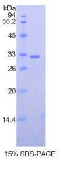 GRB2相关衔接蛋白2(GRAP2)重组蛋白