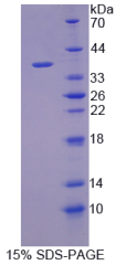 半乳糖凝集素12(GAL12)重组蛋白