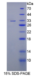 Dickkopf样蛋白1(DKKL1)重组蛋白