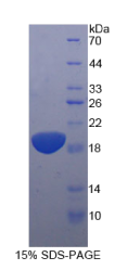 白介素11受体α(IL11Rα)重组蛋白