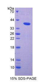 防御素β113(DEFβ113)重组蛋白