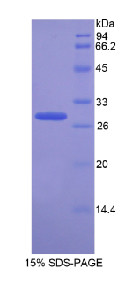 转运蛋白1(TNPO1)重组蛋白