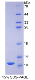 防御素β1(DEFβ1)重组蛋白