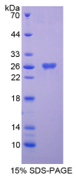 Notch同源物2(NOTCH2)重组蛋白