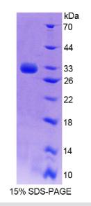 Notch同源物4(NOTCH4)重组蛋白