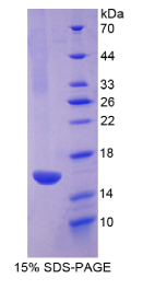 R-脊椎蛋白1(RSPO1)重组蛋白