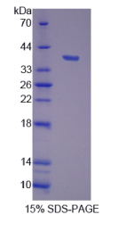 胞质分裂作用因子4(DOCK4)重组蛋白