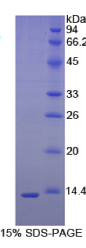 半胱氨酸蛋白酶抑制剂3(CST3)重组蛋白