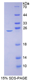 L-型电压依赖钙离子通道α1C亚基(CACNα1C)重组蛋白