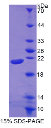 白介素1β(IL1β)重组蛋白