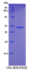 二酰甘油激酶α(DGKα)重组蛋白