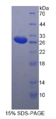 白介素2受体β(IL2Rβ)重组蛋白