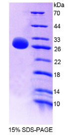 白介素22受体α2(IL22Rα2)重组蛋白