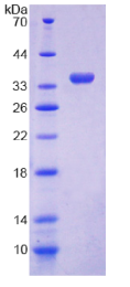 GDP解离抑制因子1(GDI1)重组蛋白