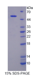 二肽基肽酶7(DPP7)重组蛋白