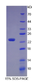 胞浆磷蛋白1(STMN1)重组蛋白